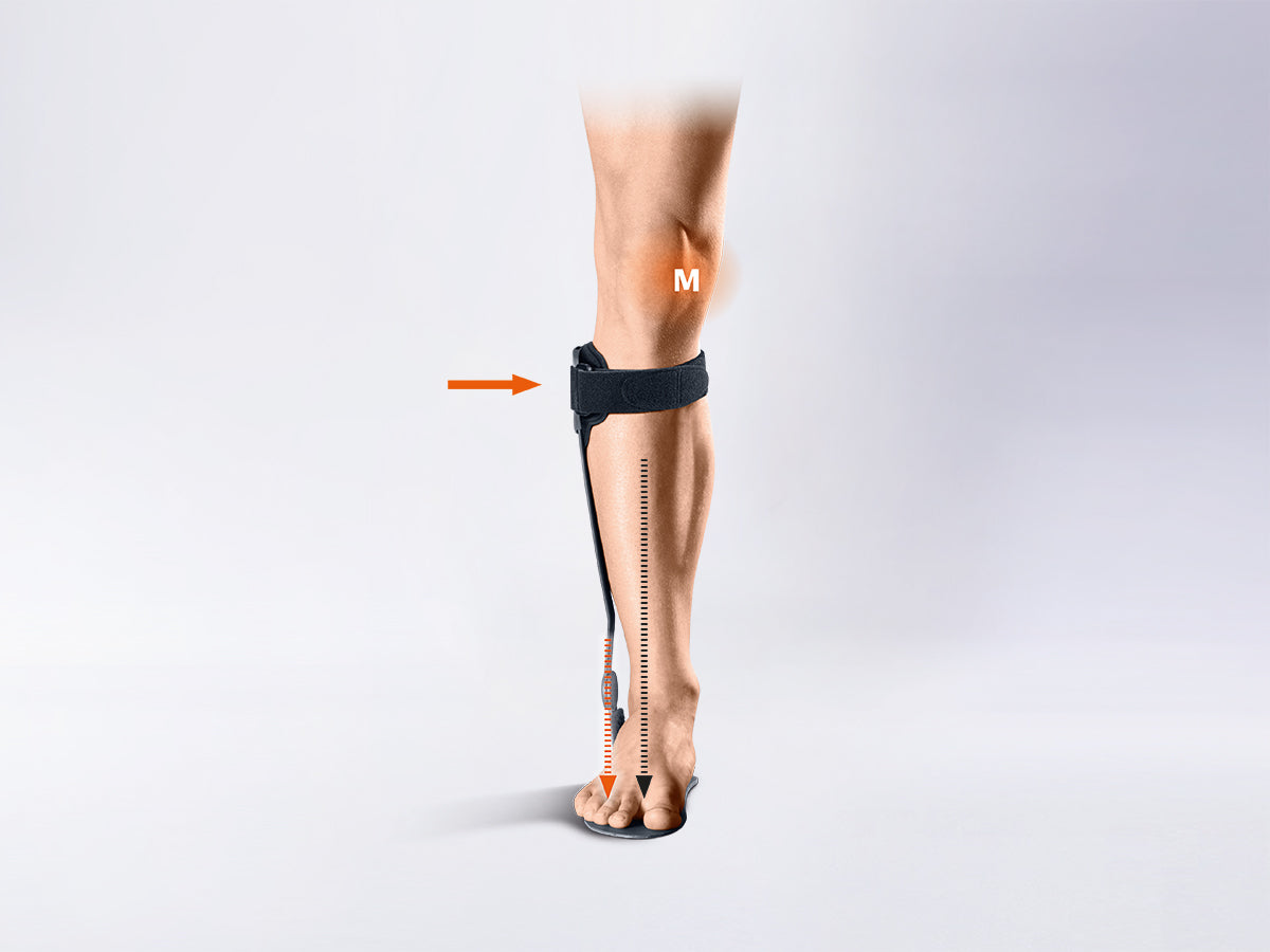 Attelle de cheville pour le traitement de la gonarthrose par décharge compartimentale Kneo