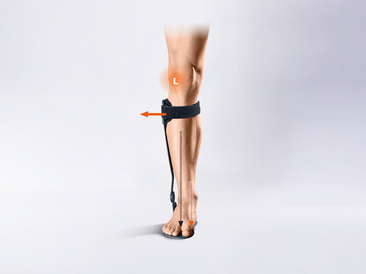 Attelle de cheville pour le traitement de la gonarthrose par décharge compartimentale Kneo