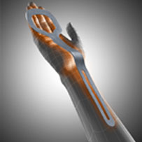Manu-Hit Digitus formable wrist-hand-finger resting orthosis
