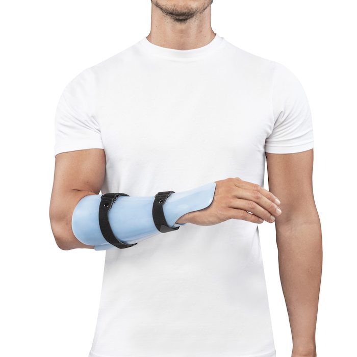 Attelle anté-brachiale thermoformable anti-extension du poignet