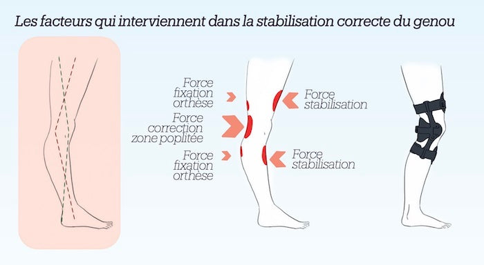 Attelle de genou Suèdoise pour le contrôle de genu-recurvatum