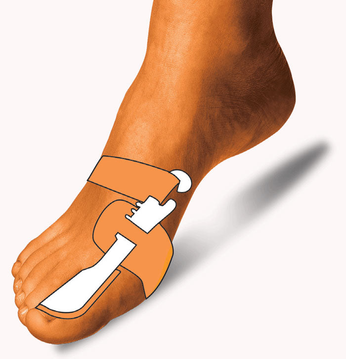 Orthèse de correction d'hallux-valgus couverture intérieure en gel Valgugel
