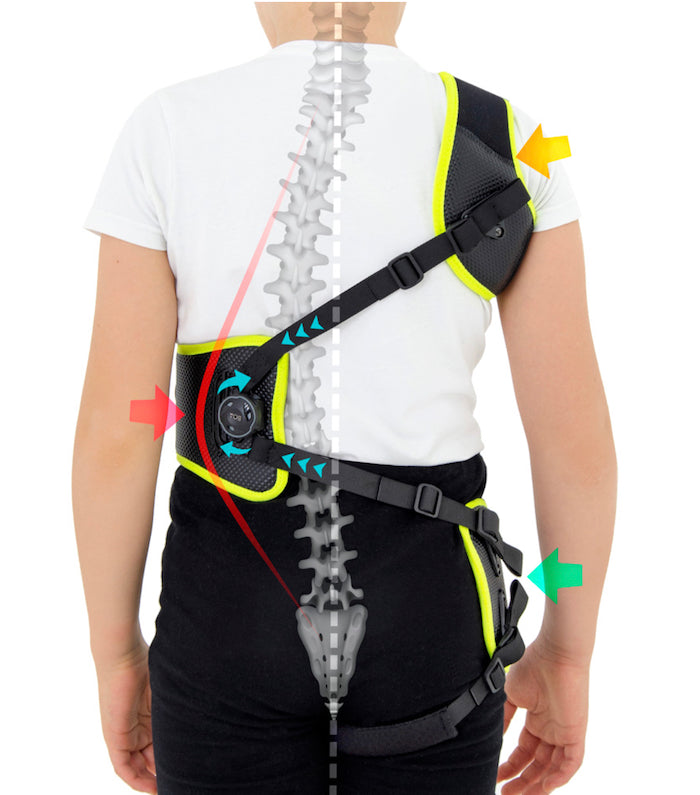Corset de correction active de la scoliose chez l'enfant