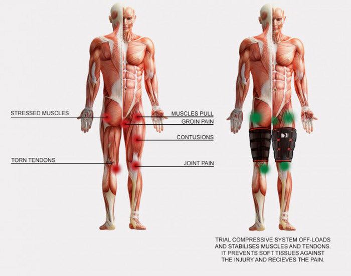 Compression shorts for strains with silicone insert