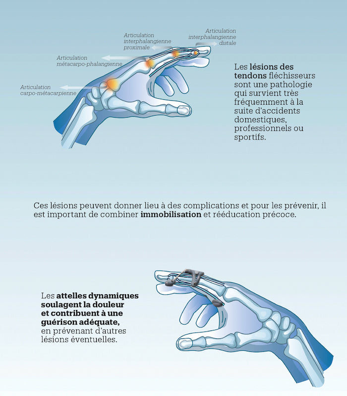 Orthèse dynamique de mise en extension du doigt type Capener FingerExt