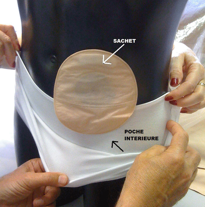 NOhole lady double wall stoma pouch support briefs