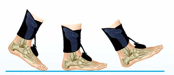 AirMed Dynamic Foot Lifter with FS3000 Mount (option)