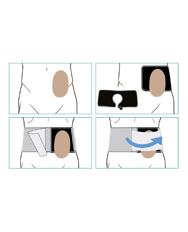 Abdominal support belt for ostomy with slit opening CS Open 16 new